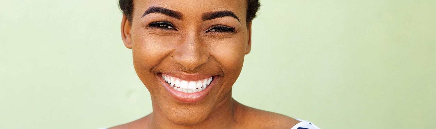 Empress Restorations - Dr. Danielle Akry, DDS.